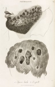 Dermatoloji Cilt hastalıkları by John Pardon