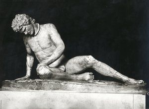 Ölen Galya, MÖ 230-220 yıllarına ait bir Yunan orijinalinin Epigonos