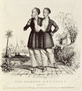 Siyam Kardeşler, 18 Yaşında, Charles Hullmandel (1789-1850), 1829 dolayları tarafından basılmıştır.