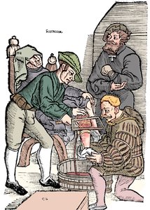 Anestezi olmadan bacağın kesilmesi, 1593 by Unbekannt