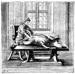Hayvandan insana kan nakli, 1679 by Unbekannt