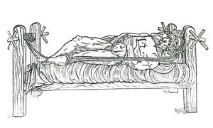 Çıkıkları azaltmak için aparat, 1544 by Unbekannt
