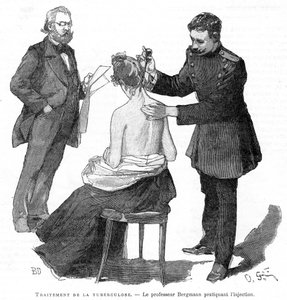 Profesör Bergmann bir tüberküloz hastasını enjekte ediyor, 1891 by Unbekannt