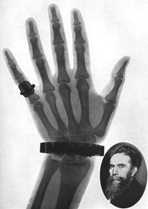 Bir elin röntgen fotoğrafı, 1926 by Unbekannt