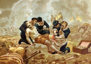 Ambroise Pare Medicine ve Fransız cerrah (c. 1509-1590) amputasyondan sonra arterlerin ligasyonu yapıyor. hombres ve Mujeres ünlülerinden sonra. Barselona 1877. by Unknown artist