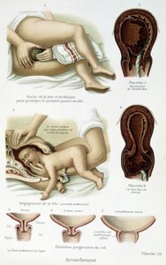 Doğum - bilim kurulu, 19. yüzyılın sonlarında by Unknown artist
