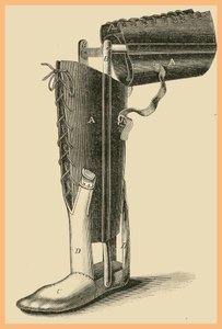 Bacak Değişimi by Unknown Artist