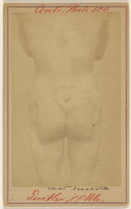 [Jno. E. Tucker, kalçasından vurulmuş, İç Savaş kurbanı] by Unknown artist