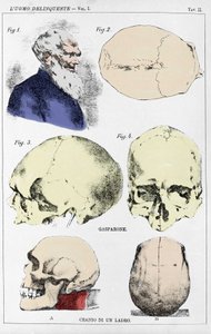 İtalyan kriminolog tarafından suçlu bir kafatasının morfolojisi üzerine çalışma by Unknown artist