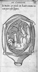 Hamilelik sırasında fetüsün rahimdeki konumu. Fransız doktor ve cerrah Ambroise Pare (1509-1590) tarafından “De la Generation des enfants”dan gravür 16. yüzyıl by Unknown artist