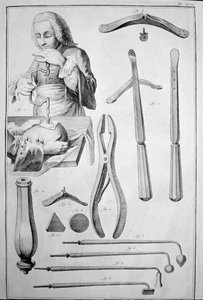 Kafatasının trepanasyonu, çeşitli aletler (gravür by Unknown artist
