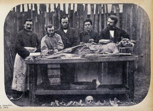 Diseksiyon, v.1865. by Unknown photographer