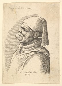 Soldan profilde, şapkalı ve şişman, alt dudağı çıkıntılı deforme olmuş bir adamın büstü, 1625-77. by Wenceslaus Hollar