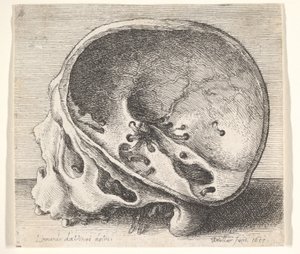 Kafatasının sol tarafı çıkarılmış, profilden sola doğru kesitli kafatası, 1651. by Wenceslaus Hollar