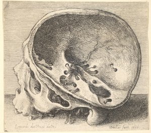 Kafatasının sol tarafı çıkarılmış, profilden sola doğru kesitli kafatası, 1651. by Wenceslaus Hollar