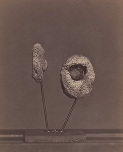 Eksize edilmiş diz eklemi. Sağ Uyluğun İç Kondilinde Yuvarlak Bir Tüfek [Gardin..., 1866-67.