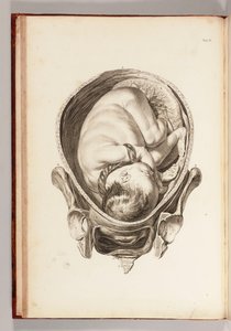 "Ebelik Uygulamasının Açıklamaları ve Bir Kısaltması ile Bir Anatomik Tablolar Seti"nden rahimdeki bir çocuğun gravürü, 1754