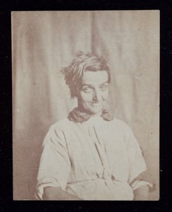 Bir hastanın Psikiyatri Portresi, Surrey County Asylum, c 1852 by John Pardon