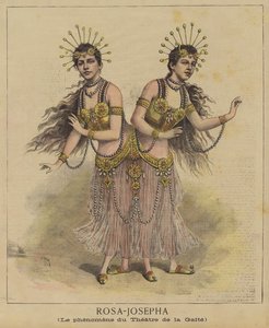 Siyam ikizleri