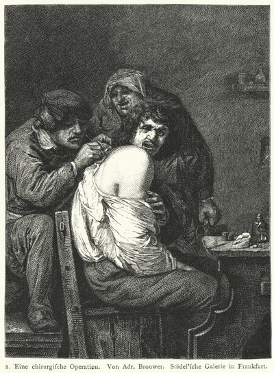 Geri Operasyon by Adriaen (after) Brouwer