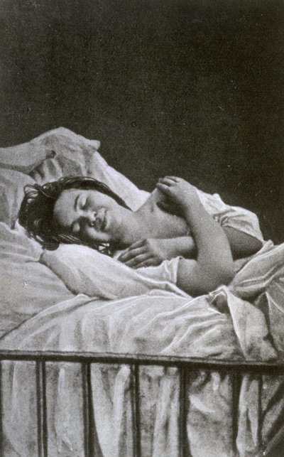 Histeri nöbeti geçiren genç kadın, 1878 by Albert Londe