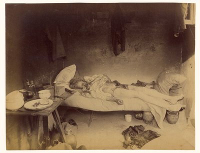  by Alphonse Bertillon