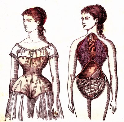 Korse sıkıştırma - Normal yaşam ve sağlık, J. Rengade. Çizim A. Demarle 1881 by Alphonse Demarle