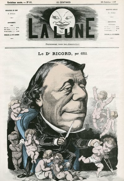 Portrait of Doctor Ricord, French doctor. Cartoon by Gill, in “La Lune”, October 20 by Andre Gill