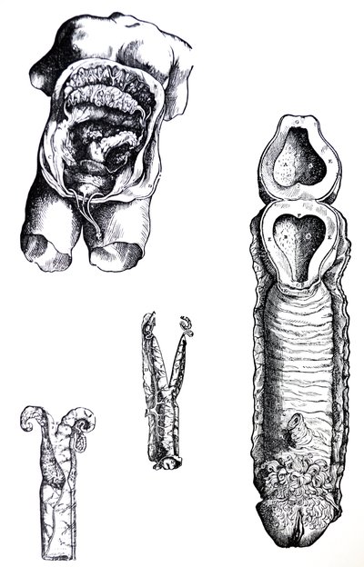 De Humani Corporis Fabrica