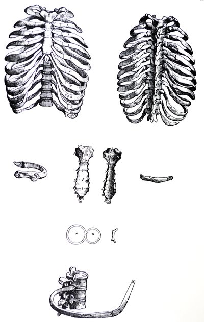 De Humani Corporis Fabrica