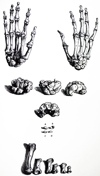 De Humani Corporis Fabrica