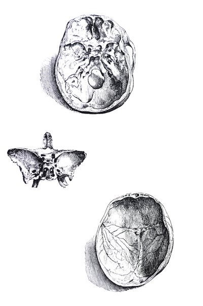 De Humani Corporis Fabrica