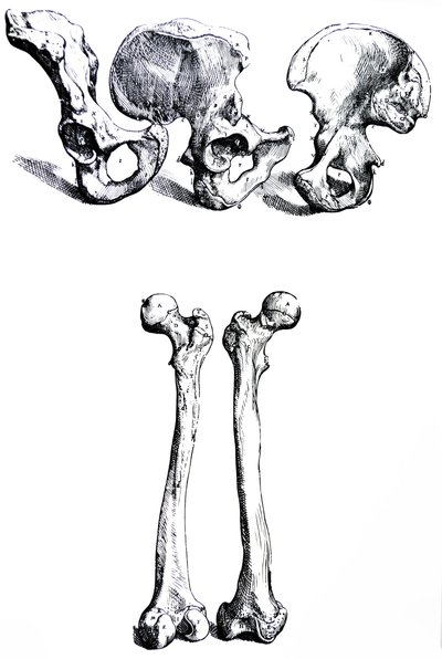De Humani Corporis Fabrica