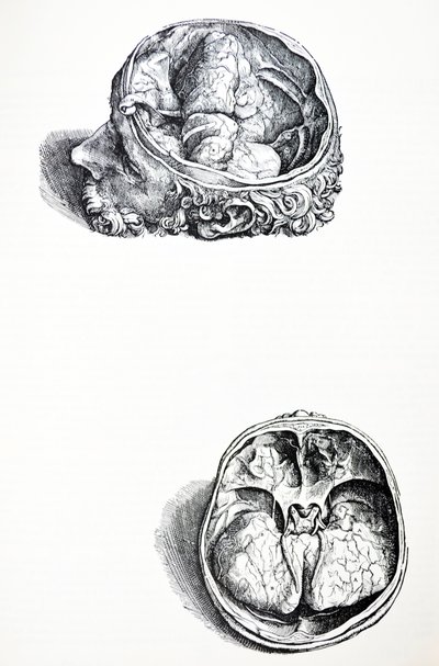 De Humani Corporis Fabrica