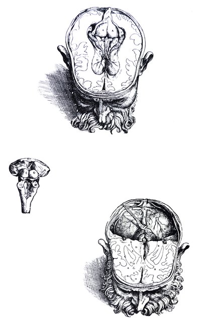 De Humani Corporis Fabrica
