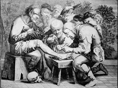 Ayak bileği ameliyatı (gravür by Anonymous Anonymous
