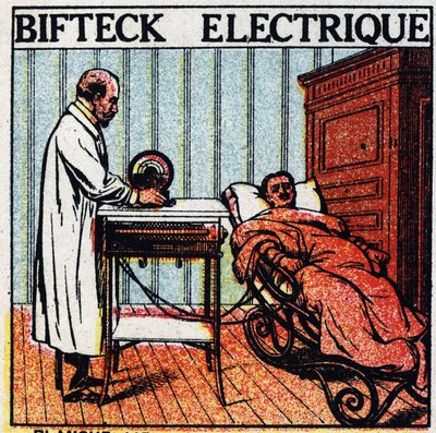 Elektriğin fizyolojik etkileri: elektrikli biftek. Çıplak metal elektrotlar kullanarak vücudundan elektrik geçirerek bir hastanın bakımı. 1925