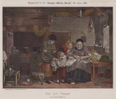 Kesik Parmak (renkli taş) by David (after) Wilkie