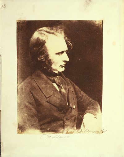 otoportre by Dr. John Adamson
