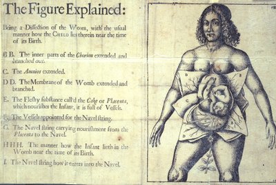 1177 b.19 Jane Sharp, Londra