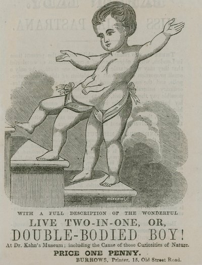 Canlı ikisi bir arada veya çift gövdeli çocuk by English School