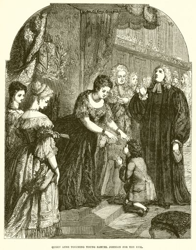Kraliçe Anne, Kötülük için Genç Samuel Johnson