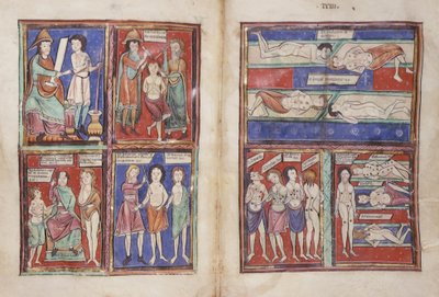 Sloane 1975 fol.91v-92 Tıbbi sahneler by English School