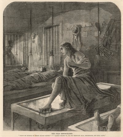 Diriltilen ölü (gravür) by English School