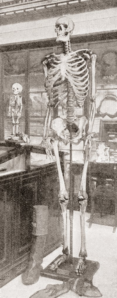 Charles Byrne'nin iskeletleri by English School