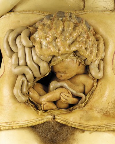 Yumurtalık hamileliğinin anatomik modeli, detay (mum) (ayrıca bkz. 1126545-7) by European School