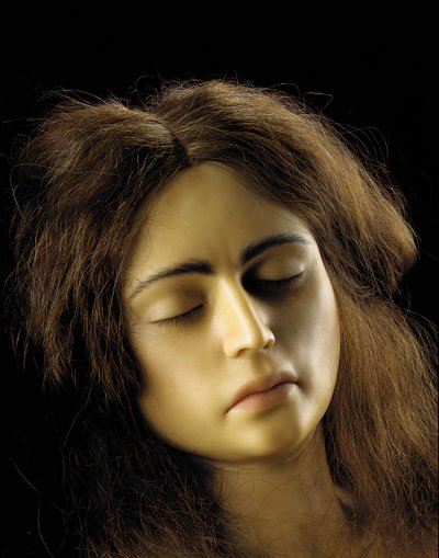 Yumurtalık hamileliğinin anatomik modeli, detay by European School