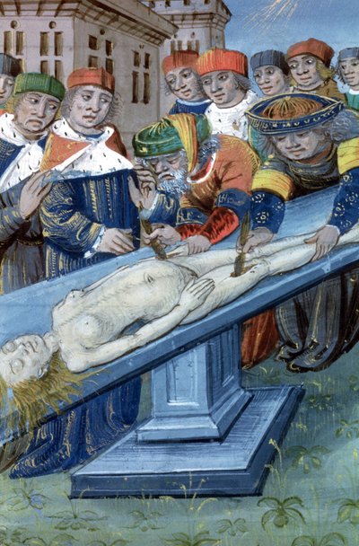 Ms Hunter 9 f.22r Diseksiyon, De Medina Fen I. II