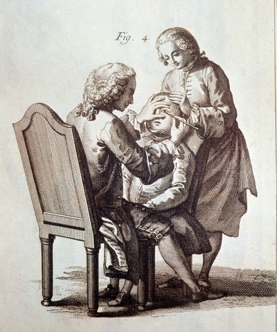 Katarakt hastasını ameliyat eden bir doktor, Denis Diderot ve Jean le Rond d
