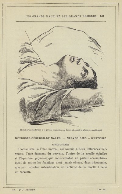 Erişimin kataleptik döneminde ve çarmıha gerilme aşamasında bir histerik tutumu (renkli lito) by French School